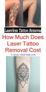 Local Tattoo Removal How To Remove Henna Tattoo Fast Stomach Tattoo Removal Eyebrow Tattoo Removal Q Sw Tattoo Removal Cost Laser Tattoo Tattoo Removal Cream