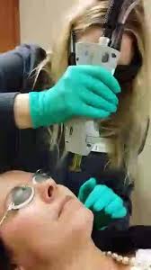 Ever thought about laser hair removal? Check out the procedure. It's this  quick and takes 6 to 8 sessions. Call Michele Ash in Cosmetic Dermatology  to make an appointment at 574.204.6347.