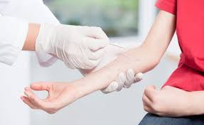 Blaschen Auf Der Hand Dyshidrosis