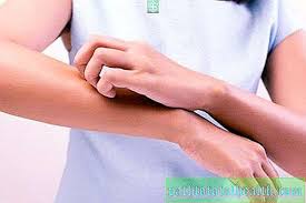 Anda boleh klik pada link ini (doctoroncall) untuk bercakap dengan doktor kami secara atas talian bagi mendapatkan. Tompok Merah Di Telapak Tangan Dan Kaki Sebab Gejala Dan Ciri Rawatan Penyakit Dan Keadaan 2021