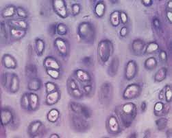 Hyaline Cartilage Histologyolm Stevegallik Org Hyaline Cartilage Anatomy And Physiology Cartilage