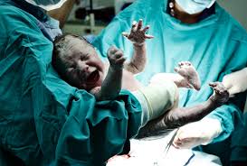 What do you need to know about failure to pass meconium? Exposure To Feces In Womb Tied To Autism Risk Spectrum Autism Research News