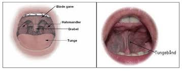 Contact klump company on messenger. Mundhule