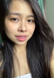 Ankle Arthroscopy Insights for OFWs in Taiwan