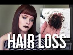 On a positive note, this dream also signifies freedom from debts! My Hair Loss Story Youtube