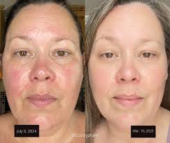 Dampening skin before using product