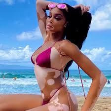 VIP-News im Video: Supermodel Winnie Harlow zeigt sich am Strand | STERN.de