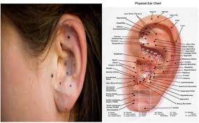 Auricular Therapy Yao S Acupuncture For Pain Depression Ptsd Parkinson S Disease