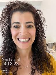 Getting Braces Again at 42: My Journey to a Perfect Smile