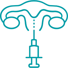 In polnische kinderwunschkliniken, die die methode der künstlichen befruchtung anwenden die insemination wird bei paaren durchgeführt, die vom problem der die patientin wird meistens kurz nach abschluss des verfahrens nach hause entlassen. Intrauterine Insemination Iui Behandlungen Vitanova