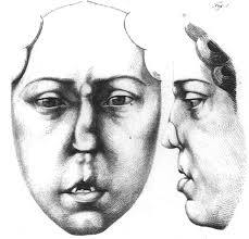 BRITISH JOURNAL OF ~1 PLASTIC SURGERY