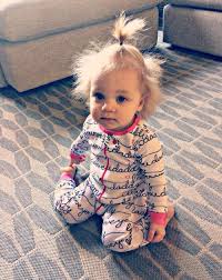 French braids are hard with toddler hair, but this tutorial has a trick to make it work. This Adorable Toddler Has Uncombable Hair Syndrome And It S A Rare Genetic Quirk