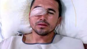 Balbuena va al quirófano