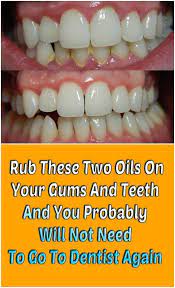 Pin By Teresa Benson On Health And Fitness Gum Care Gum Health Teeth Health