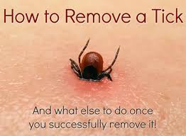 Image result for Tick Removal