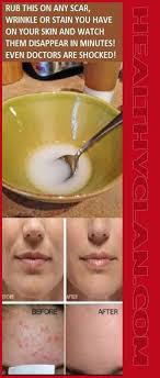 Pin By Gona Singh On Kids Art Health And Beauty Tips Skin Treatments Health And Beauty