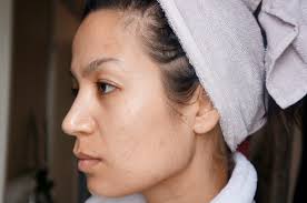 Snelle oplossing voor pigmentvlekken ⋆ Beautylab.nl