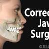 Once there they can modify and slide the front part of your jaw back to reposition it where the best bite alignment is. Https Encrypted Tbn0 Gstatic Com Images Q Tbn And9gcq2zhlpsvbwufw26pejki5qwsmm Z3qroxmwn Utucocxokymfo Usqp Cau