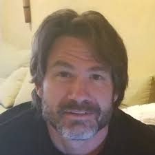 attune #depuysynthes #medialstabilized #kneerestoration  #californiapacificothropedics #sutter