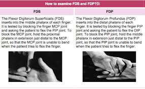 Extensor pollicis longus (epl) instruct the patient to lay their hand flat on a table and to lift only your thumb off the table insertion: Http Ksumsc Com Download Center Archive 3rd 433 433 20teams 20work Surgery 20team 2nd 20semester L17 20hand 20injuries Pdf