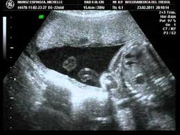 On 26 de maio de 2014 at 22:09. Como Esta Formado Mi Bebe A Las 22 Semanas De Embarazo Impedimento Semana A Semana Justamente Crece Tu Hijo