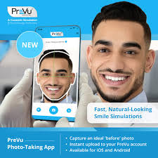 Mastering High-Value Case Acceptance with Smile Simulations