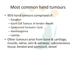 Hand Tumours Most Common Hand Tumours 95 Hand Tumours Comprised Of Ganglion Giant Cell Tumour Of Tendon Sheath Epidermoid Inclusion Cysts Haemangioma Ppt Download