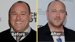 Mad TV Star Will Sasso's 200-Pound Weight Loss: A Journey of Determination  and Self-Transformation