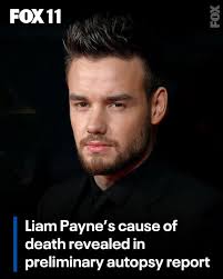 Liam Payne's preliminary autopsy report reveals how the former One  Direction singer died. MORE ⬇️