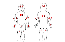 burn bsa diagram catalogue of schemas