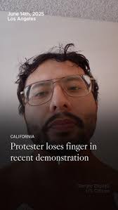 Less-lethal weapons cause physical, psychological harm, critics say