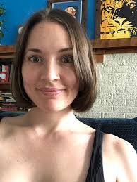 Granddaughter's first degree burns from hot soup accident