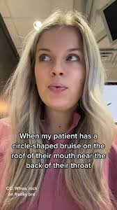 🙈🙈🙈 Someone’s palatal petechiae is none of my business