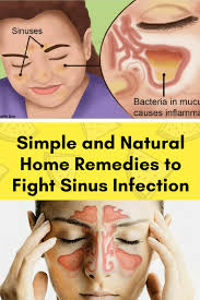 Simple And Natural Home Remedies To Fight Sinus Infection Natural Home Remedies Sinusitis Sinus Allergies
