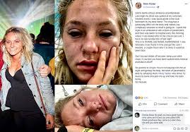 University student Emily Mimi Walter 19 spiked at Falmouth nightclub  Cornwall