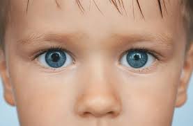 An aneurysm is a weak spot in a blood vessel in the brain. Anisocoria Unequal Pupils All About Vision
