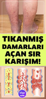Damarlarinizi Tertemiz Yapacak Sir Tarif Saglik Saglik Ve Fitness Saglik Ipuclari