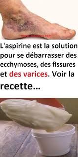 Les bienfaits du citron les bienfaits de l'ail les bienfaits du thym les bienfaits du miel les bienfaits de la elle est riche en dérivés salicylés au même titre que le saule (salix alba) et a donné son nom à l'aspirine. Pin On Astuces Sante