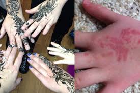Xmasir henna tattoo stencil kit/temporary tattoo template set of 20 sheets, indian arabian tattoo stickers mehndi stencils body art designs for hands. 37 Black Henna Tattoo Rash Treatment