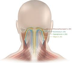 Neck muscles are of four types. Mr Neurographic Evaluation Of Facial And Neck Pain Normal And Abnormal Craniospinal Nerves Below The Skull Base Radiographics