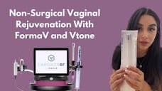 Non-Surgical Vaginal Rejuvenation with FormaV and Vtone - YouTube