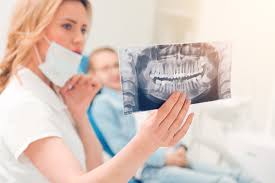 Sie stoßen auf den gegenkiefer. Weisheitszahne Dr Med Dent Enno Mijatovic Ihr Oralchirurg In Berlin