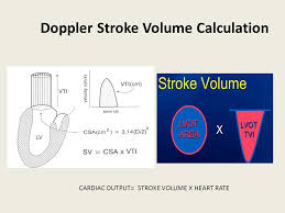 How to calculate stroke volume. Evaluation Of Systolic Function Of Left Ventricle By Echocardiography Ppt Video Online Download