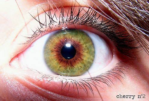 Mga resulta ng larawan para sa sectoral heterochromia. A green eye with a brown section."