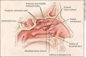 Adult Rhinosinusitis Diagnosis And Management American Family Physician