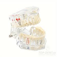 Image result for ochrana chrupu