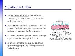 Myasthenia Gravis A Neurologist S Perspective Ppt Video Online Download