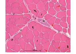 Check spelling or type a new query. Mammalian Skeletal Muscle In Cross Section Murine Tibialis Anterior Download Scientific Diagram