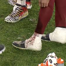 Nfl quarterback alex smith suffered a gruesome leg injury that put his career in jeopardy and had him fighting for his life, and his long and grueling road to recovery is chronicled in an upcoming he nearly had to have his leg amputated. Alex Smith Had A Seriously Bloody Lower Leg Late In First Half But Finishes Upset Win Photo Video Draftkings Nation