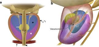 General signs and symptoms of advanced and metastatic cancer can include: Locally Advanced Prostate Cancer Imaging Findings And Implications For Treatment From The Surgical Perspective Springerlink